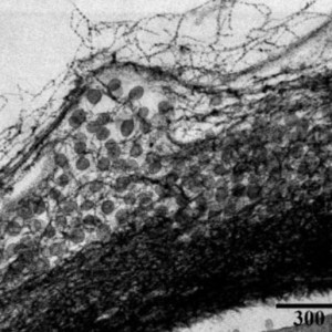 Detail polymerního obalu buňky Azotobacter vinelandii (zdroj: ÚPT AV ČR)