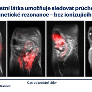 Průchod polymerní kontrastní látky trávicím traktem potkana v čase. Červeně je znázorněn její signál zachycený pomocí fluorové magnetické rezonance (¹⁹F MRI). Foto: Archiv ÚOCHB