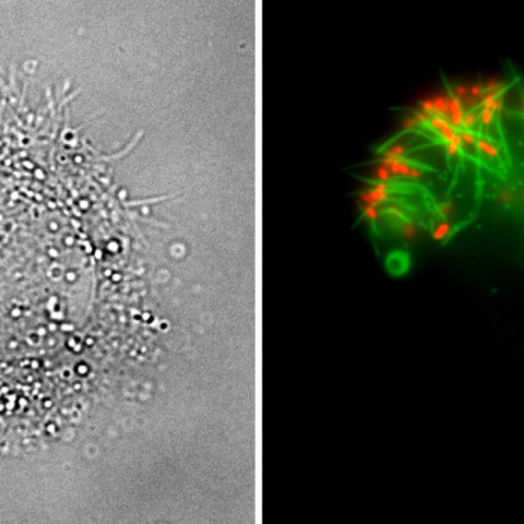Bakterie černého kašle využívají unikátní trik k osídlení dýchacích cest